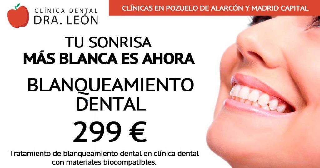 promoción blanqueamiento dental Madrid