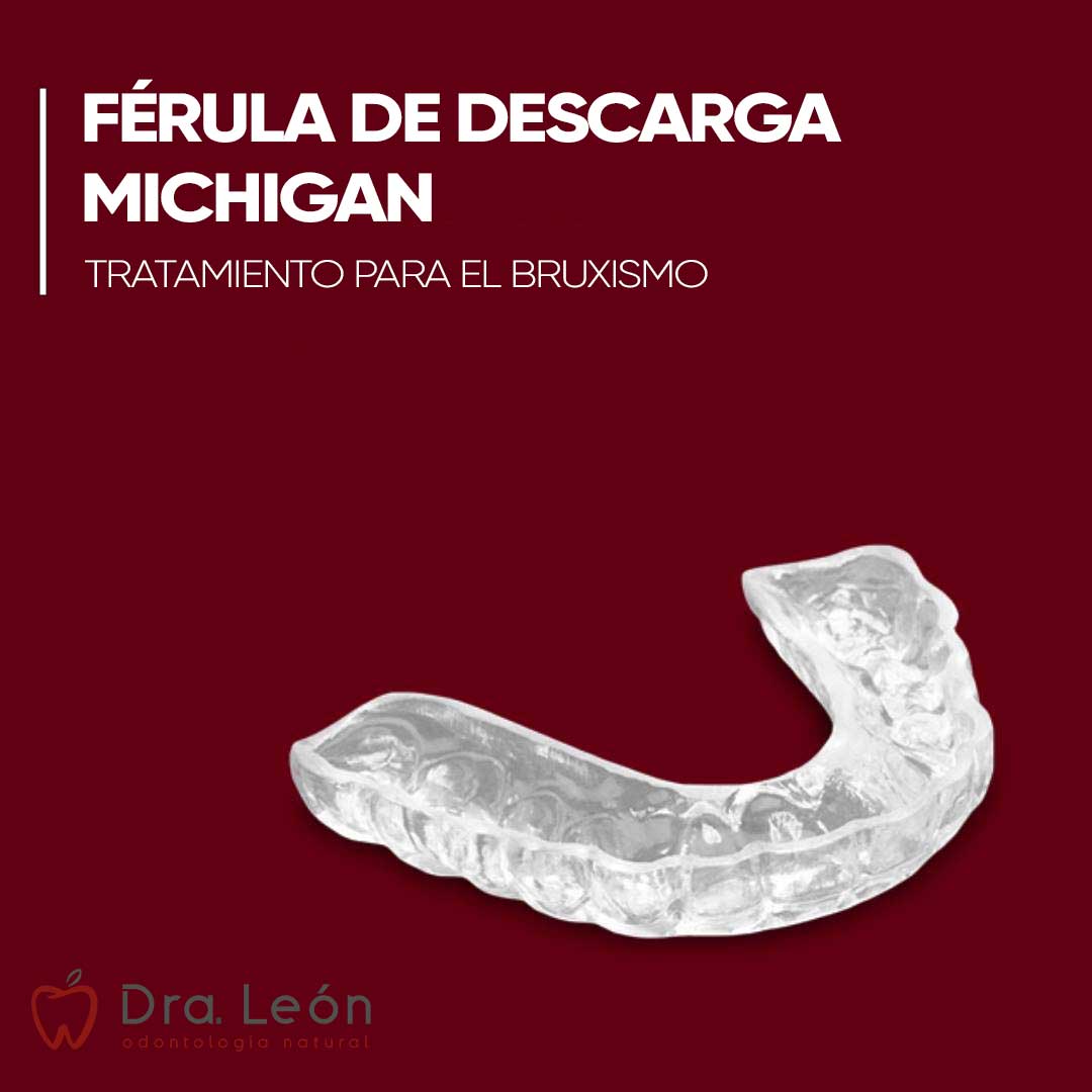 bruxismo-ferula-descarga-michigan-madrid