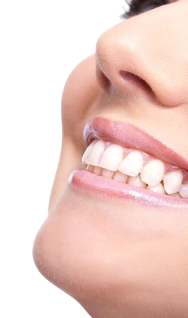 diseno-sonrisa-resultados-madrid
