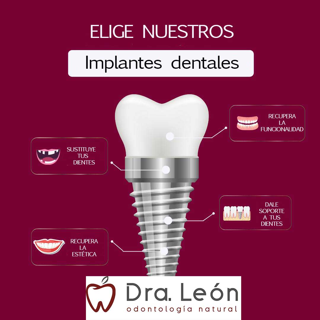 elegir-clinica-implantes-dentales-madrid