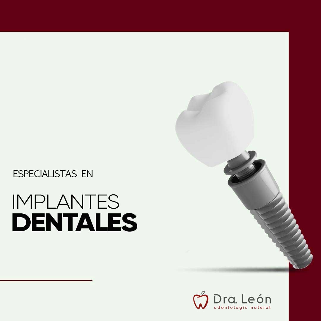 especialista-implantes-dentales-madrid