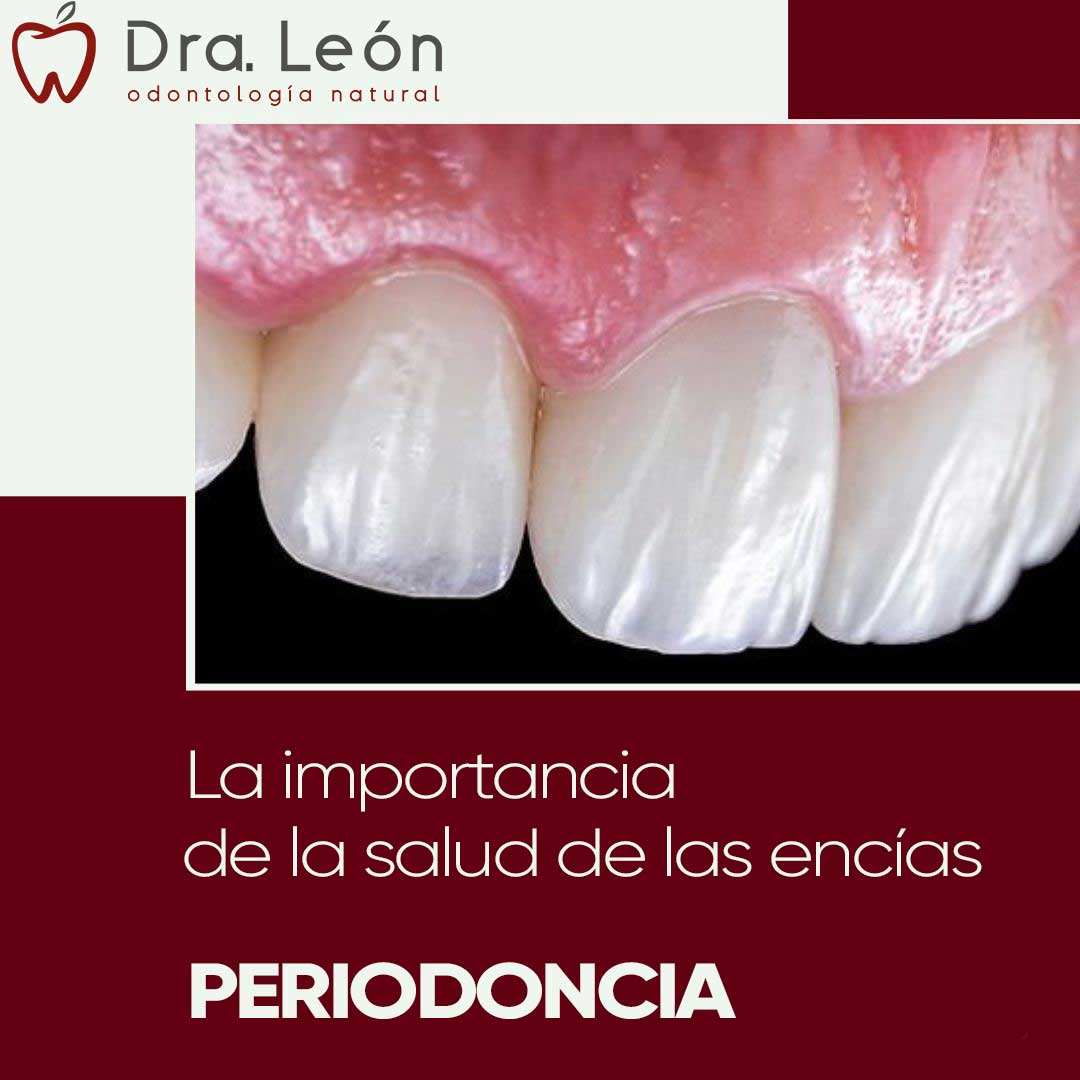 Especialista periodoncia Madrid