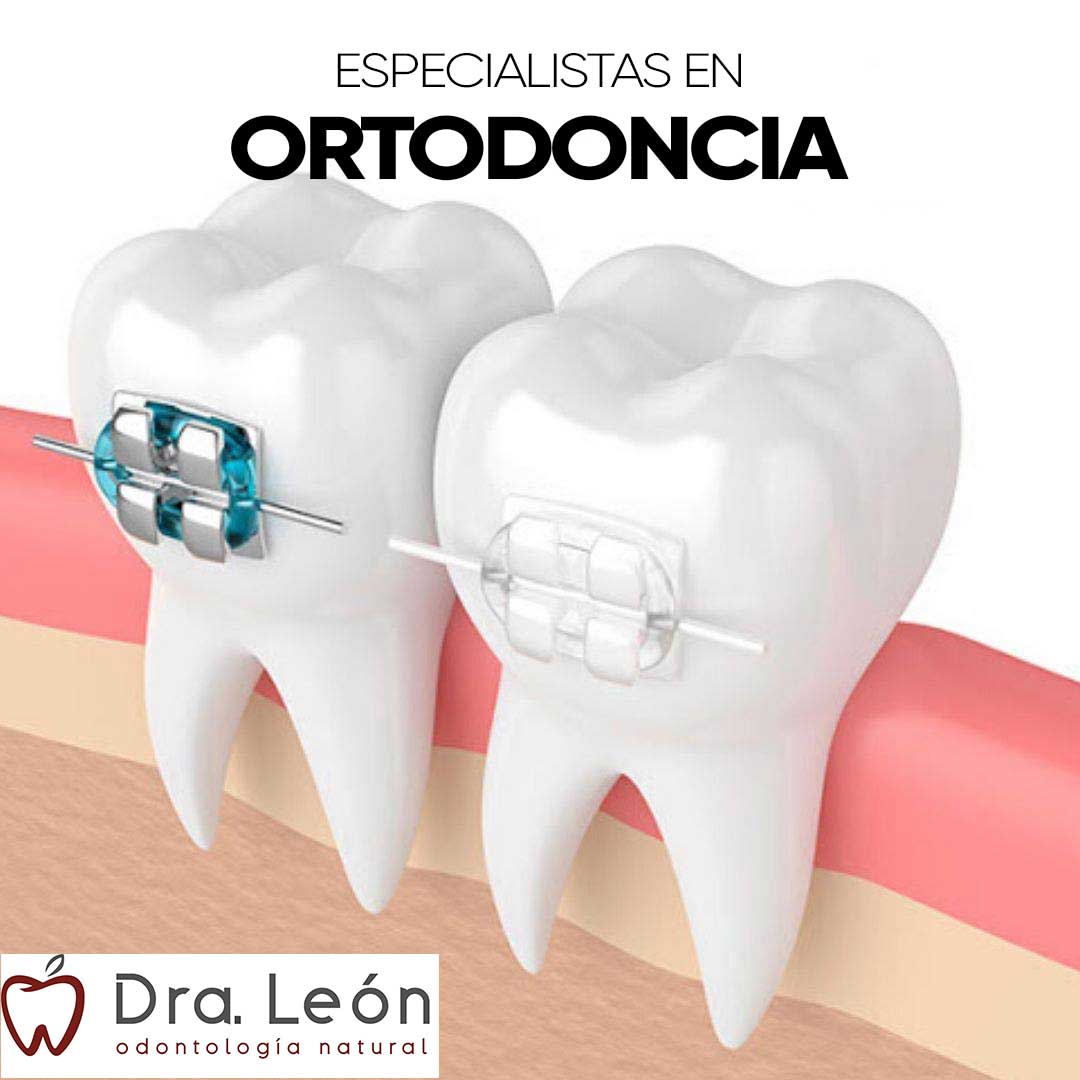 especialistas ortodoncia Madrid