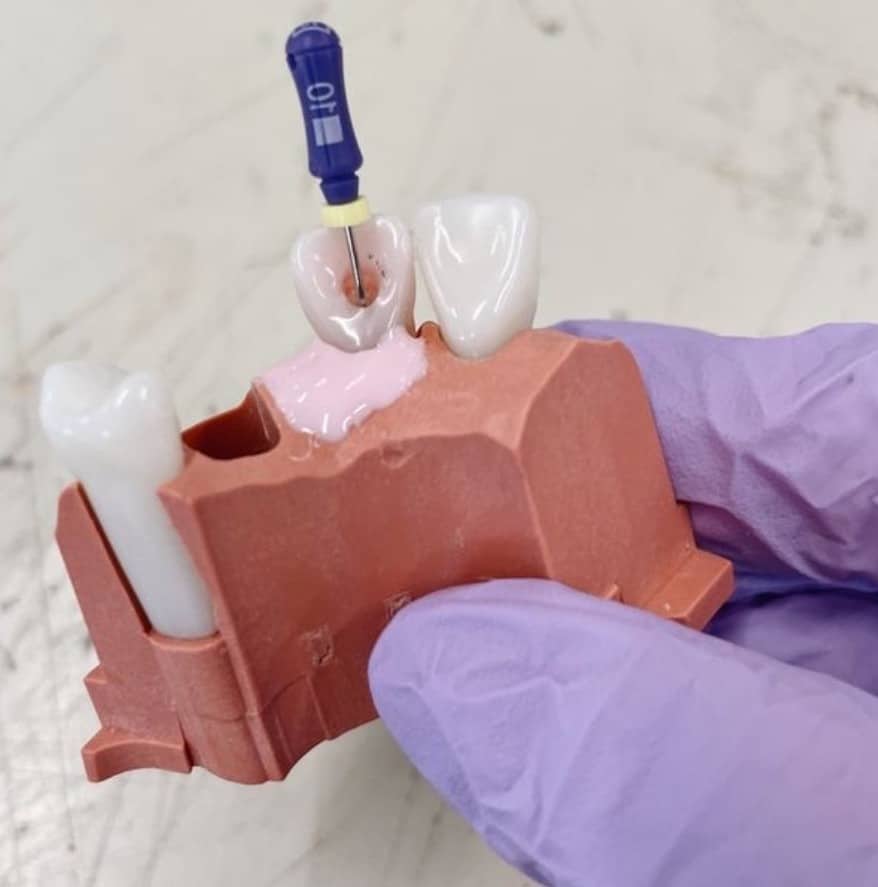 grafico-hacer-endodoncia