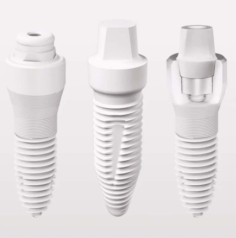 implantes-dentales-de-zirconio-madrid