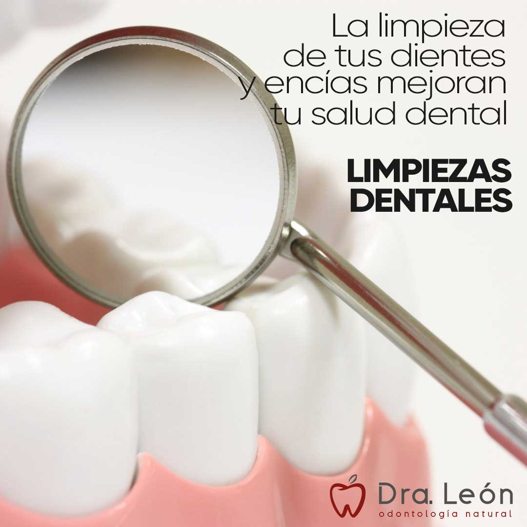 limpieza-dental-madrid