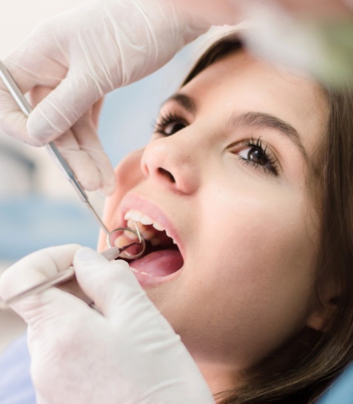 limpieza dental de sarro en Madrid