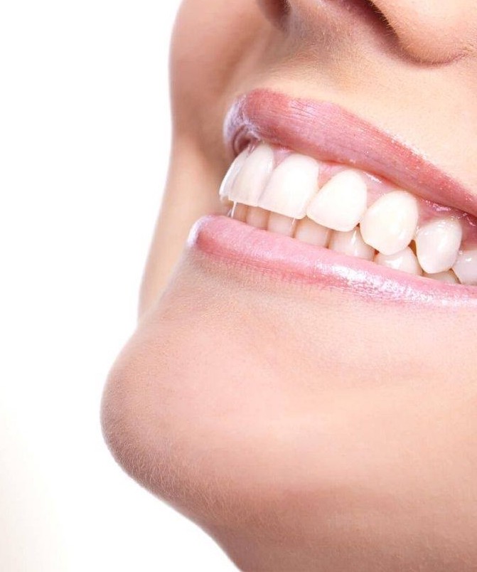 sonrisa-mas-joven-madrid