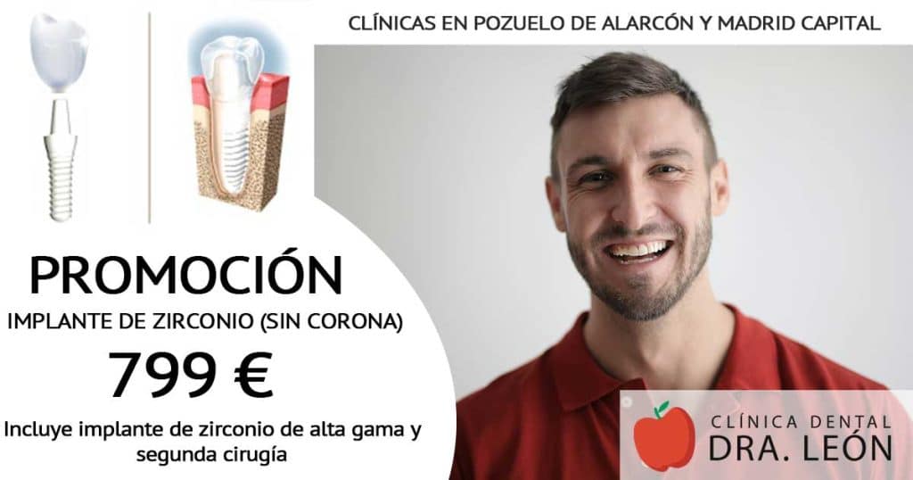 Promoción implantes dentales de zirconio Madrid