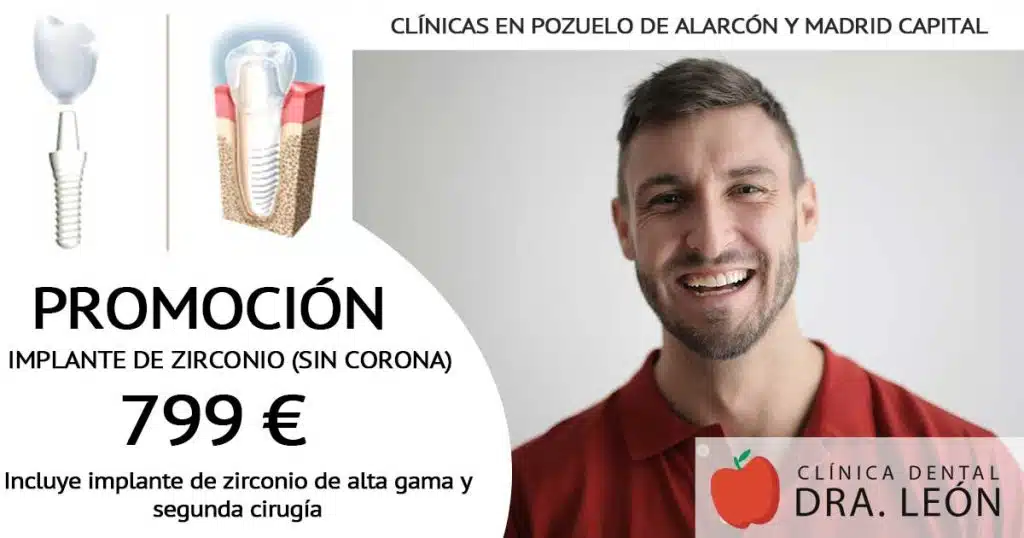 Promoción implantes dentales de zirconio Madrid