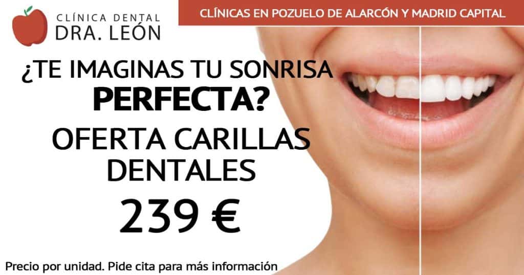 oferta carillas dentales Madrid